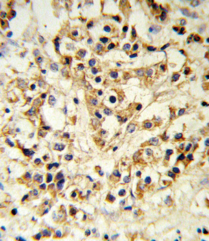 FGFR1 Antibody
