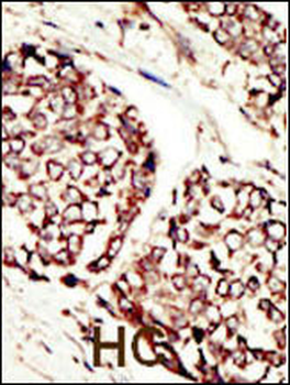 ERBB3 Antibody (N-term)