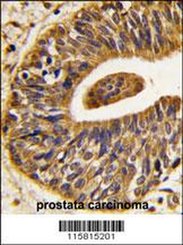 ERBB2 Antibody(C-term Y1248)