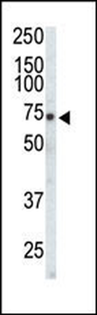 EphA3 Antibody (C-term)