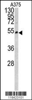 LUM Antibody (Center)
