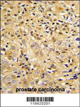 LUM Antibody (Center)