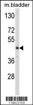 LUM Antibody (N-term)