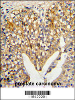 LUM Antibody (N-term)