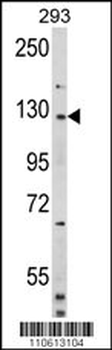 DAAM2 Antibody (N-term)