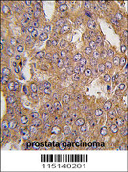 NARS2 Antibody (C-term)