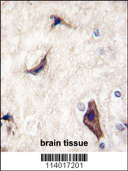 RASGRF1 Antibody (S929)