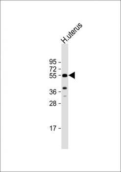 Aromatase (CYP19A1) Antibody (C-term)