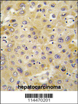 PBP (PPBP) Antibody (C-term)