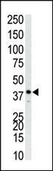 MAPK14 Antibody (C-term)