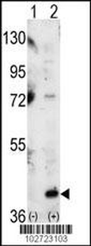 MAPK14 Antibody (C-term)