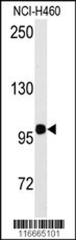 HIPK2 Antibody (Y361)