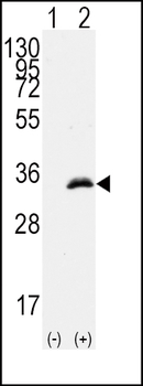 CDK1 Antibody (T14)
