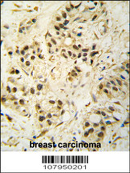 CDK1 Antibody (T14)