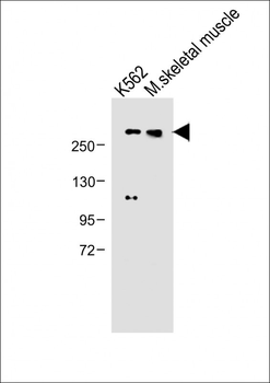 ADAMTS13 Antibody (Center)