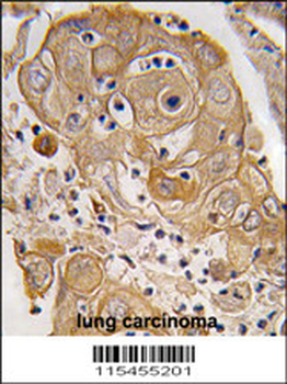 PTRF Antibody (N-term)