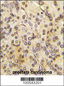 MEN1 Antibody (T594)