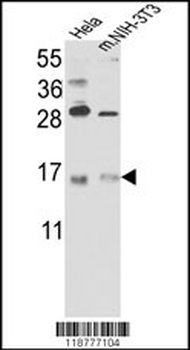 RBM3 Antibody (C-term)
