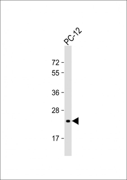 DHFR Antibody (C-term)