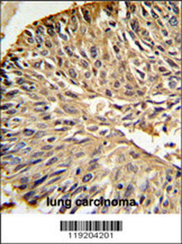 DHFR Antibody (C-term)