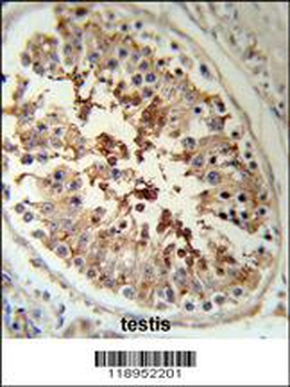 SERPINH1 Antibody (Center)
