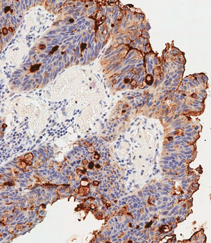 CEACAM Antibody (N-term)