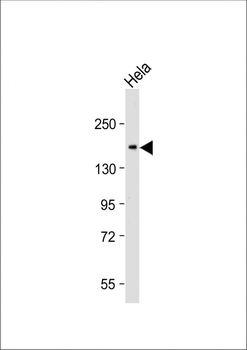 CEACAM Antibody (N-term)