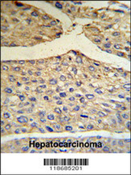 BF Antibody (Center)