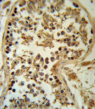 SMYD3 Antibody (N-term)