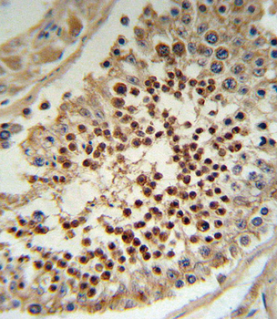 KLF5 Antibody (C-term)