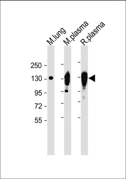 CP Antibody (Center)