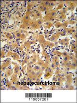CP Antibody (N-term)