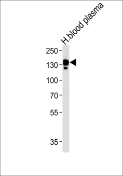 CP Antibody (N-term)