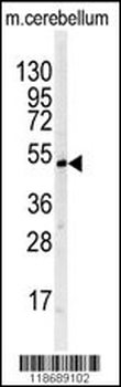 BTBD1 Antibody (Center)