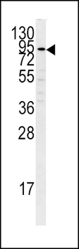 PLG Antibody (C-term)