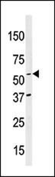 NAE1 (APPBP1) Antibody (C-term)