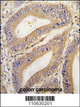 REA (PHB2) Antibody (N-term)