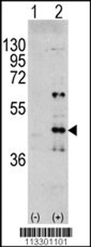 MAPK3 Antibody (Y204)