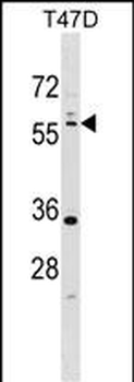 STK11 (LKB1) Antibody (N-term I29)