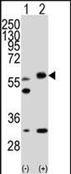STK11 (LKB1) Antibody (N-term I29)