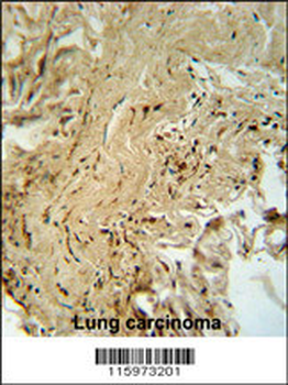MAPK14 Antibody (T180/Y182)