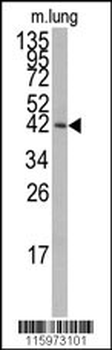 MAPK14 Antibody (T180/Y182)