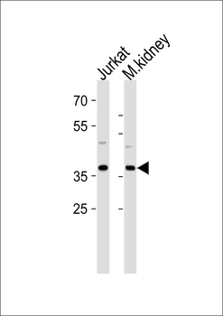 MAPK14 Antibody (Y323)