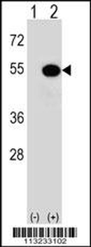 PRAK (MAPKAPK5) Antibody (T182)
