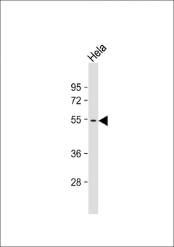 PRAK (MAPKAPK5) Antibody (T182)