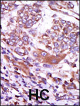 CAMK2D (CAMK2 delta) Antibody (C-term)