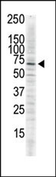 CAMK2D (CAMK2 delta) Antibody (C-term)