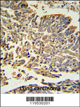 HSP27 Antibody (Center)