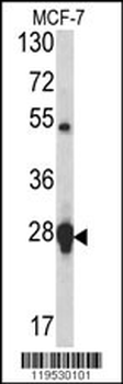 HSP27 Antibody (Center)