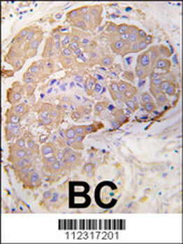 HSPB1 Antibody (S82)